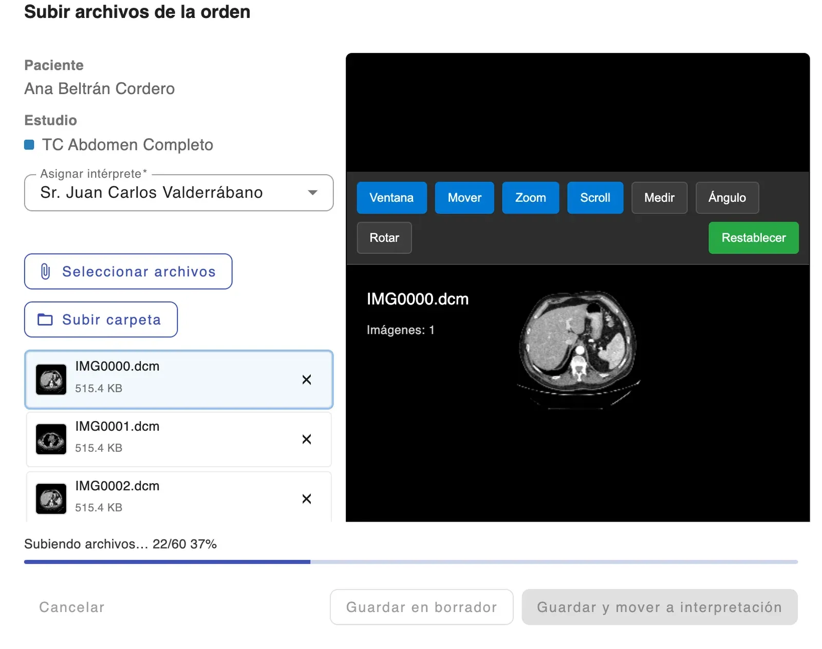 Captura de la cola de carga con la vista previa por serie