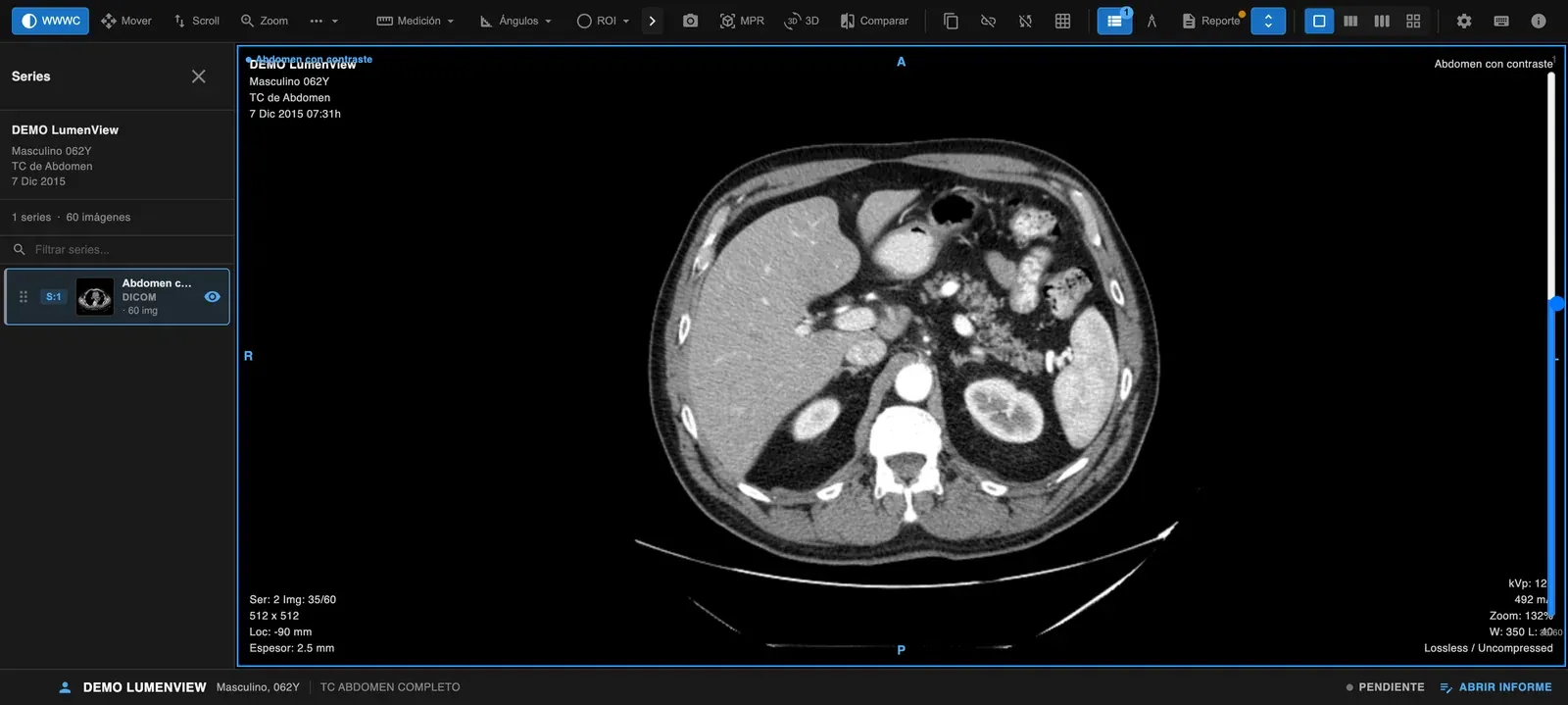 El visor DICOM de LumenView con una tomografía abierta y el panel completo de herramientas: ventana, mediciones, ángulos, ROI, MPR y 3D